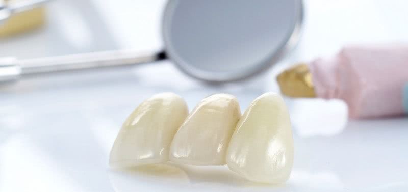 Non-removable dentures