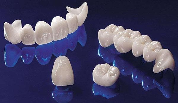 Безметалловые керамические коронки на зубы.