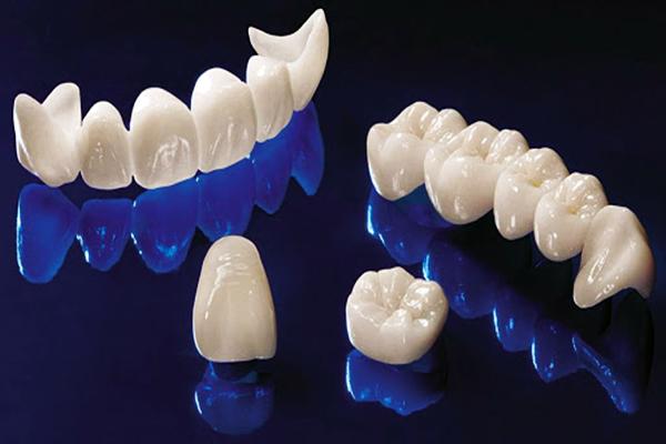 Zirkonkronen sind aufgrund ihrer hohen Ähnlichkeit mit echten Zähnen und ihrer Festigkeit die beste Option für Zahnprothesen.