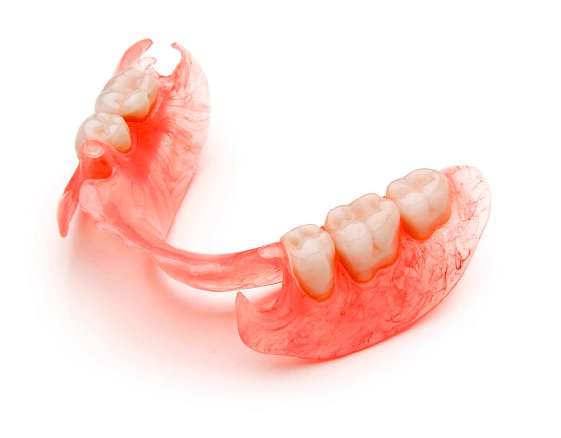 Nylonprothesen sind angenehm zu tragen, weisen jedoch charakteristische Merkmale auf, die sie von anderen Zähnen unterscheiden können. Die Stärke dieser Prothese ist ziemlich hoch.