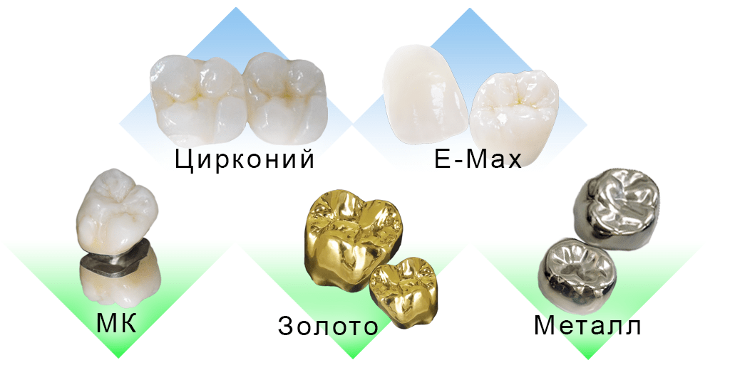 Dental Crown in Minsk