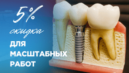 Dental implant discount