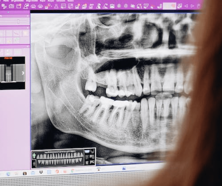 Diagnostic Methods in Jaw Treatment