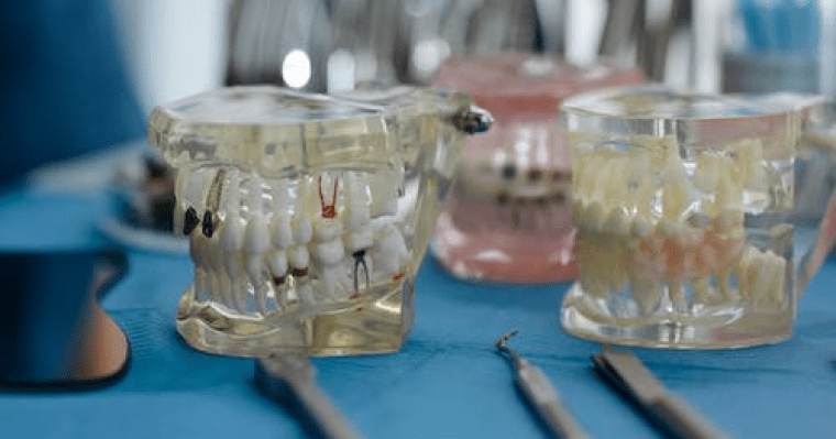 Моделирование челюстей при лечении челюсти